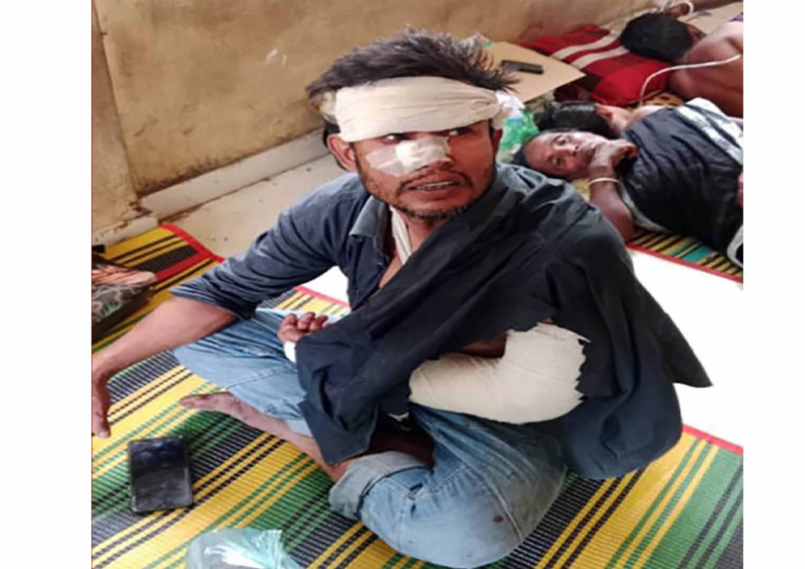 পারিবারিক বিরোধে বড় ভাইকে কুপিয়ে জখমের অভিযোগ ছোট ভাইয়ের বিরুদ্ধে