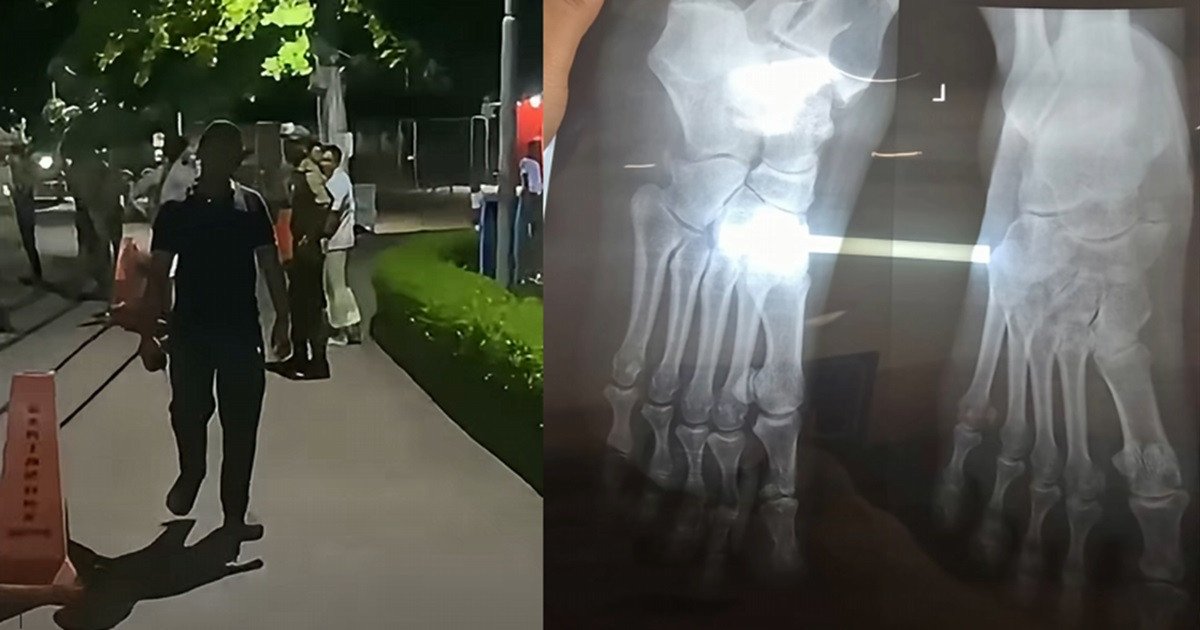 বারিধারা ডিওএইচএসে বিড়ালকে খাবার দেওয়ার সময় বাসিন্দাদের ওপর নিরাপত্তাকর্মীদের হামলা