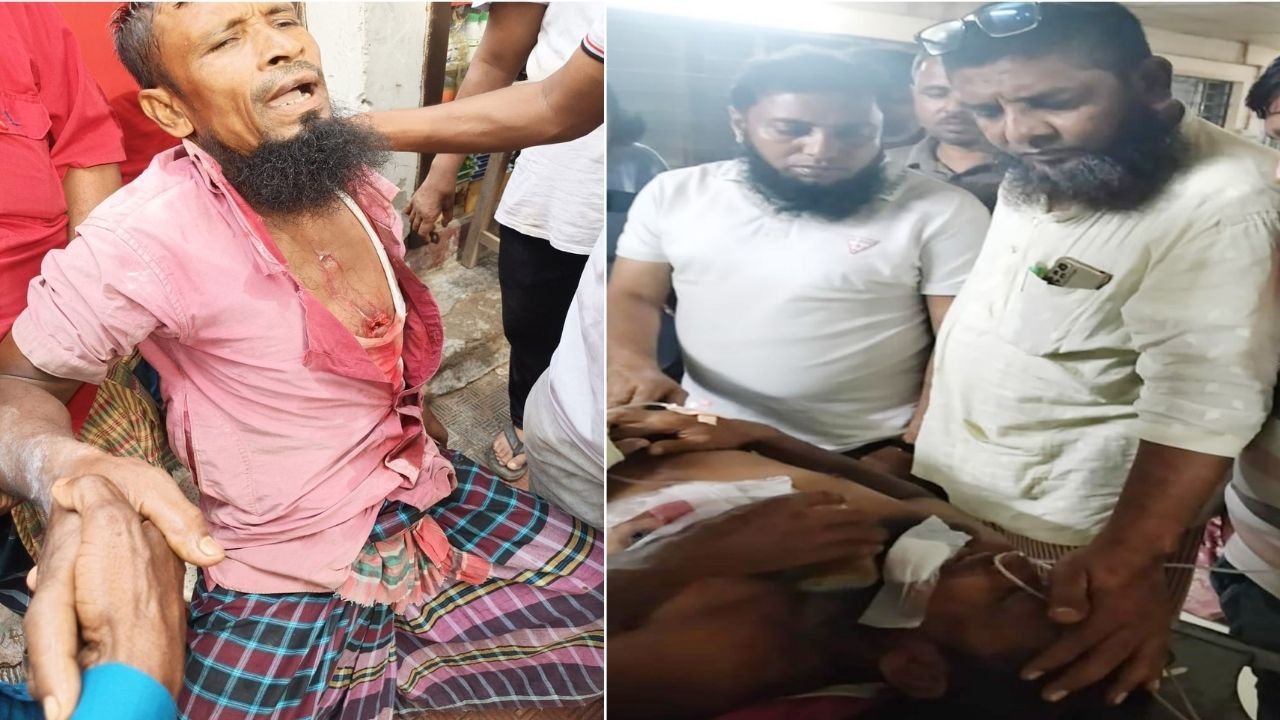 বেনাপোল স্থলবন্দরে ফর্কলিফটের তার ছিঁড়ে শ্রমিক গুরুতর আহত