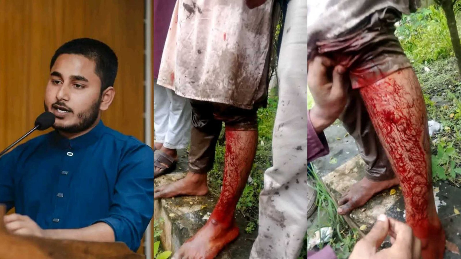বরিশাল বিশ্ববিদ্যালয়ে ছাত্রদল ও ছাত্রশিবিরের সংঘর্ষ, আহত একাধিক