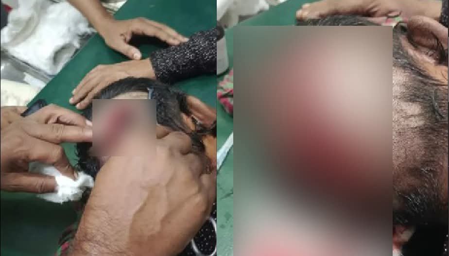 নালিতাবাড়ীতে বাসায় হামলা চালিয়ে দুই সহোদরকে কুপিয়ে জখম
