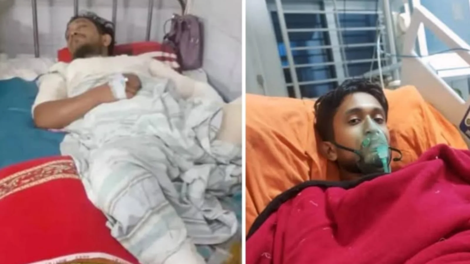 আগুনে ঝলসে যাওয়া সাব্বিরের চিকিৎসায় সহায়তার আকুতি