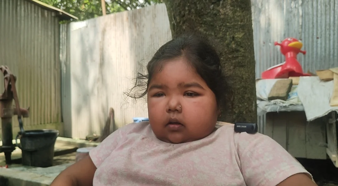 ১৫ বছর ধরে জটিল কিডনি রোগে ধুঁকছে জুঁই