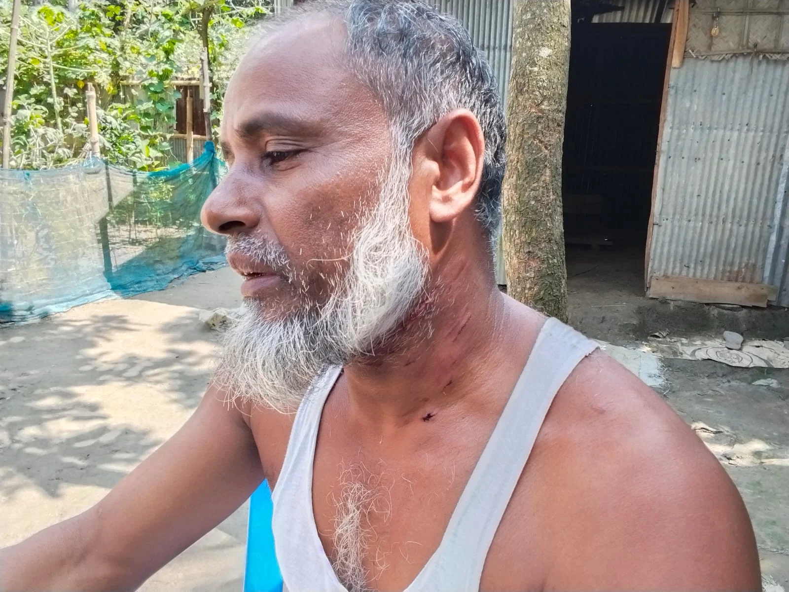 কুকুরের হামলায় শিশুসহ ৮ জন আহত, গবাদিপশুও রেহাই পায়নি