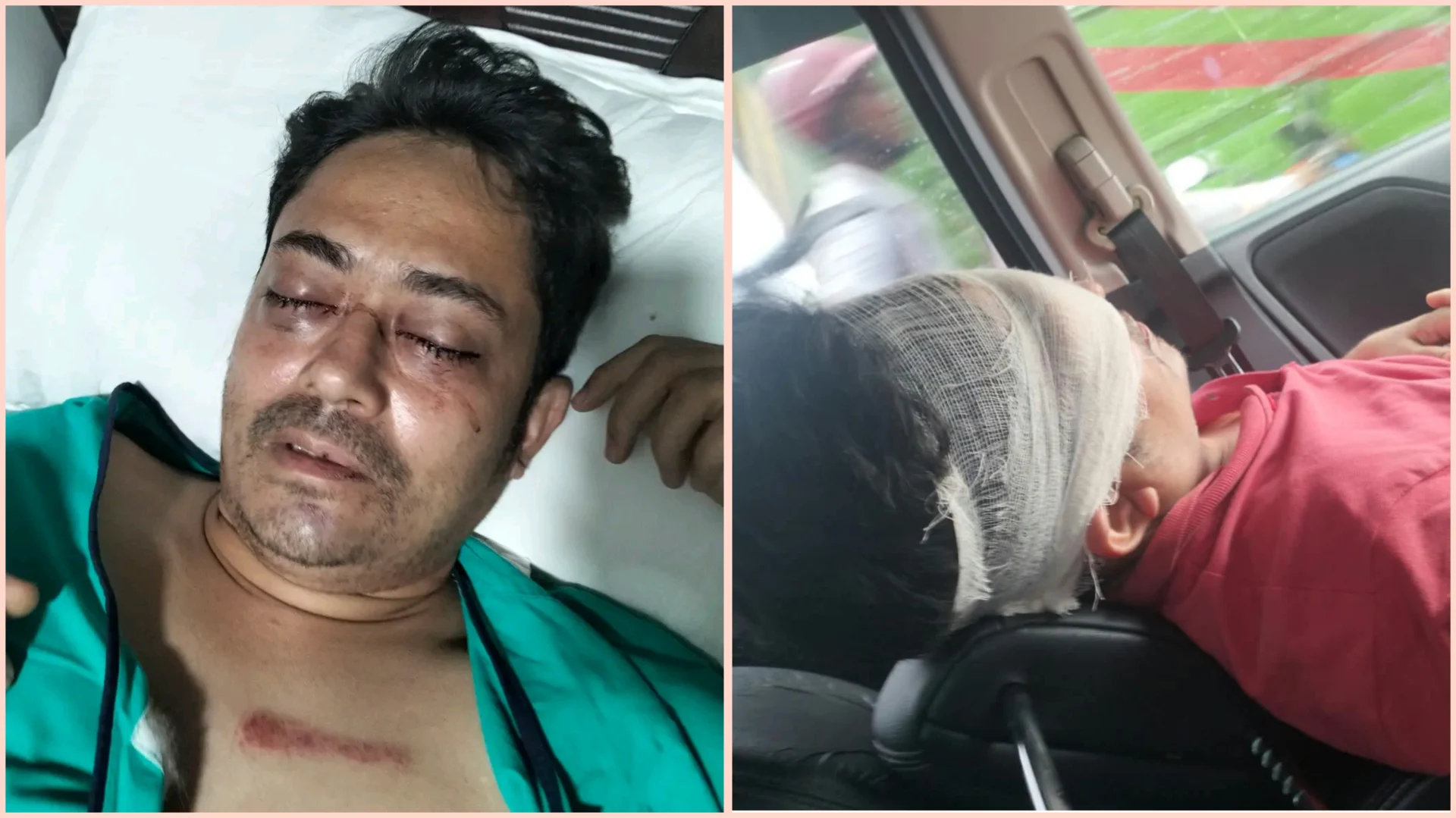 মলম পার্টি ও ছিনতাইকারী চক্রের নৃশংস হামলায় গুরুতর আহত তেজগাঁও কলেজের শিক্ষক