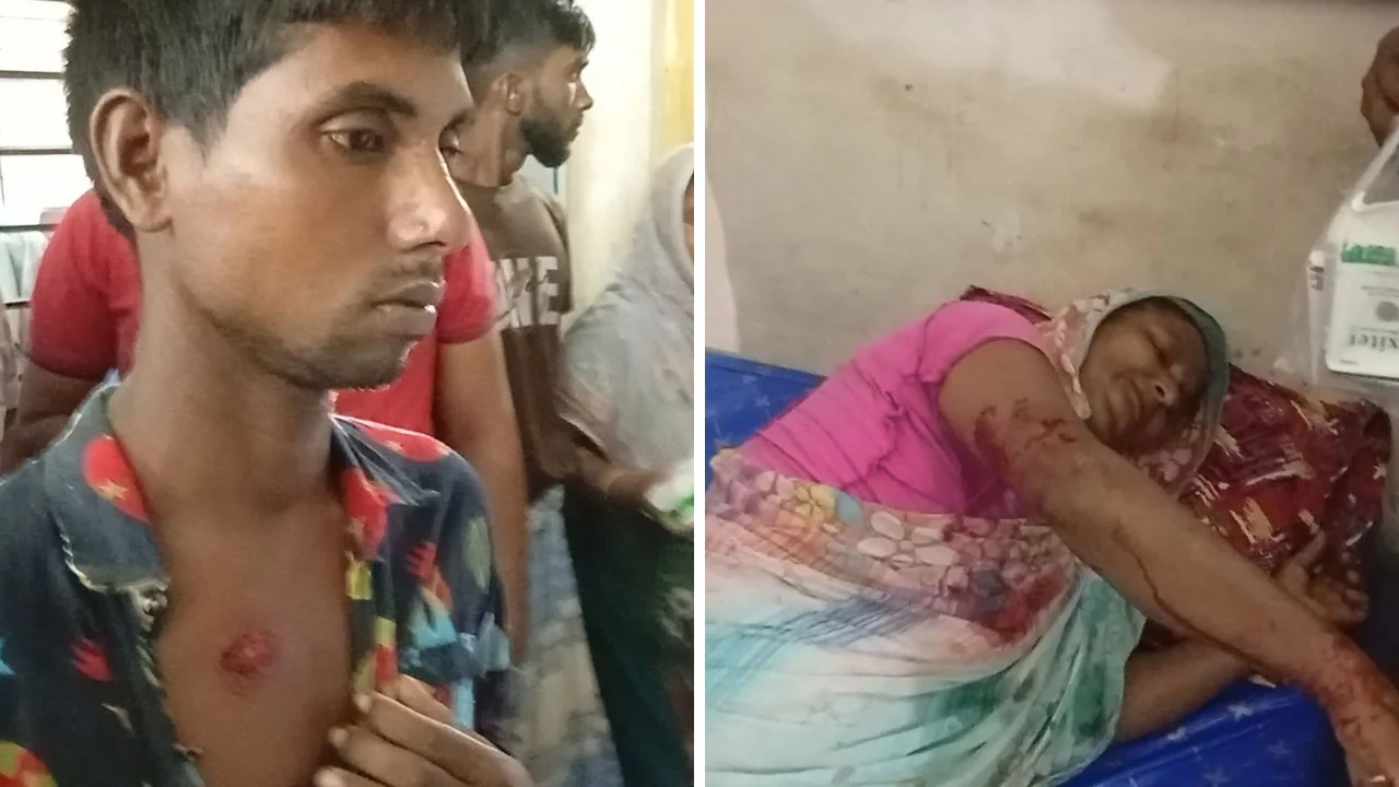 মিঠাপুকুরে কুকুরের কামড়ে একদিনে আহত ৩০, ছড়িয়েছে আতঙ্ক