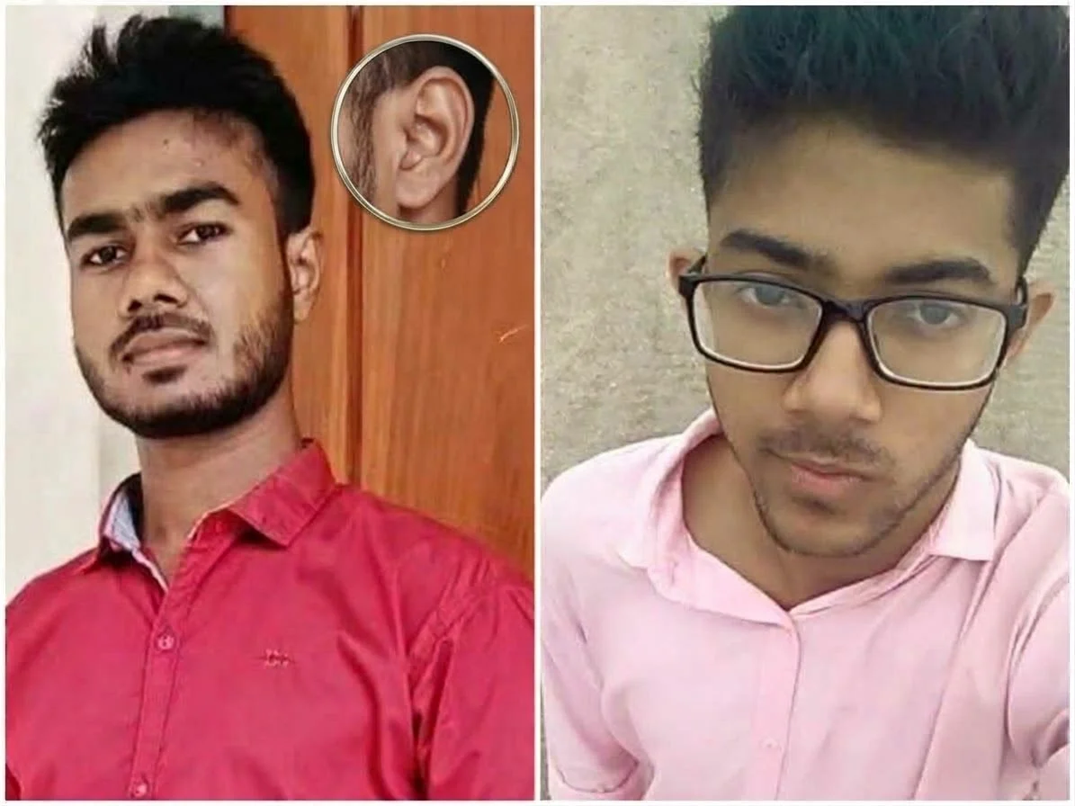 যবিপ্রবিতে শিক্ষার্থীকে মারধর, কানের পর্দা ক্ষতিগ্রস্তের দাবি